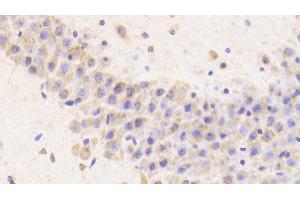 Detection of CTSD in Mouse Cerebellum Tissue using Polyclonal Antibody to Cathepsin D (CTSD) (Cathepsin D 抗体  (AA 66-410))