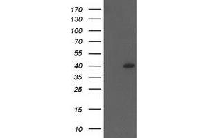 Western Blotting (WB) image for anti-HSPA Binding Protein, Cytoplasmic Cochaperone 1 (HSPBP1) antibody (ABIN1498760) (HSPBP1 抗体)