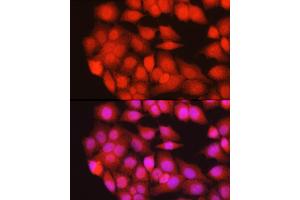 Immunofluorescence analysis of HeLa cells using TRIM63 Rabbit pAb (ABIN3017372, ABIN3017373, ABIN3017374 and ABIN6220060) at dilution of 1:200 (40x lens). (TRIM63 抗体)