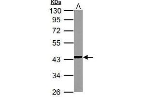 Western Blotting (WB) image for anti-NADH Dehydrogenase (Ubiquinone) 1 alpha Subcomplex, 10, 42kDa (NDUFA10) (Center) antibody (ABIN2856963)