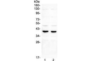 Western blot testing of 1) rat testis, 2) mouse testis, 3) rat brain, 4) mouse brain and 5) human U87 lysate with DMRT1 antibody. (DMRT1 抗体)