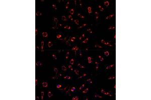 Immunofluorescence analysis of L929 cells using PAH antibody (ABIN3015512, ABIN3015513, ABIN3015514 and ABIN6218620) at dilution of 1:100. (Phenylalanine Hydroxylase 抗体  (AA 1-290))