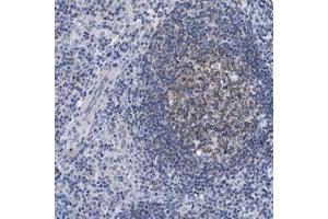 Immunohistochemical staining of human lymph node with LRMP polyclonal antibody  shows moderate cytoplasmic positivity in reaction center cells at 1:500-1:1000 dilution. (LRMP 抗体)