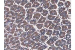 Immunohistochemistry (IHC) image for anti-ATPase, H+/K+ Exchanging, alpha Polypeptide (ATP4A) (AA 786-1014) antibody (ABIN7436267)