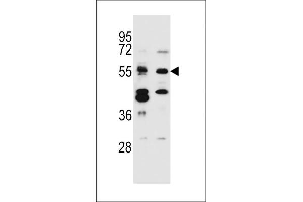 CELF3 抗体  (N-Term)