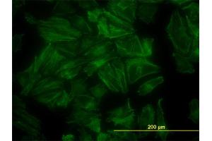 Immunofluorescence of monoclonal antibody to PDLIM7 on HeLa cell. (PDLIM7 抗体  (AA 1-457))