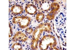 IHC analysis of FFPE human kidney section using SPHK1 antibody; Ab was diluted at 1:100. (SPHK1 抗体  (AA 59-89))