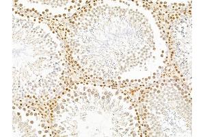 ABIN7094797 and ABIN7098848 at 1/100 staining Rat testis tissue by IHC-P.