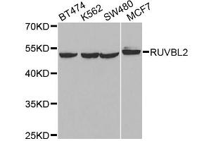 Western blot analysis of extracts of various cell lines, using RUVBL2 antibody. (RUVBL2 抗体)