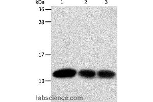 Western blot analysis of Hela and MCF7 cell, human liver cancer tissue, using TXN Polyclonal Antibody at dilution of 1:600 (TXN 抗体)