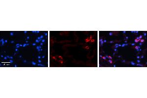 Immunohistochemistry (IHC) image for anti-Insulin-Like Growth Factor Binding Protein 7 (IGFBP7) (C-Term) antibody (ABIN2773913) (IGFBP7 抗体  (C-Term))