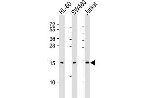 All lanes : Anti-KISS1 Antibody (C-Term) at 1:2000 dilution Lane 1: HL-60 whole cell lysates Lane 2: S whole cell lysates Lane 3: Jurkat whole cell lysates Lysates/proteins at 20 μg per lane. (KISS1 抗体  (AA 115-145))
