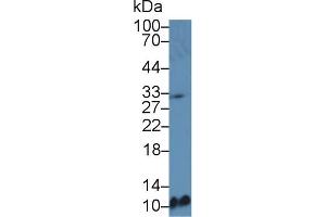 Western blot analysis of Mouse Spleen lysate, using Mouse MDC Antibody (5 µg/ml) and HRP-conjugated Goat Anti-Rabbit antibody ( (CCL22 抗体  (AA 29-92))