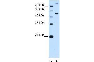 PPAT antibody used at 0. (PPAT 抗体  (N-Term))