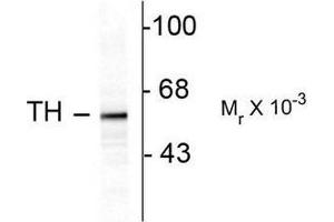 Image no. 1 for anti-Tyrosine Hydroxylase (TH) antibody (ABIN372735) (Tyrosine Hydroxylase 抗体)