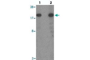 Western blot analysis of TSC22D3 in human small intestine tissue with TSC22D3 polyclonal antibody  at (lane 1) 1 and (lane 2) 2 ug/mL. (TSC22D3 抗体  (N-Term))