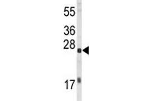 Western blot analysis of EIF4E antibody and HL-60 lysate. (EIF4E 抗体)