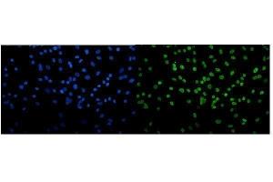 IF analysis of Transketolase/TKT using anti-Transketolase/TKT antibody (ABIN7598958).