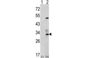 Western Blotting (WB) image for anti-Capping Protein (Actin Filament) Muscle Z-Line, beta (CAPZB) antibody (ABIN3001693) (CAPZB 抗体)