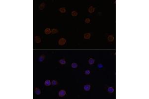 Immunofluorescence analysis of Y79 cells using  Polyclonal Antibody (ABIN6129705, ABIN6136904, ABIN6136906 and ABIN6220328) at dilution of 1:100 (40x lens). (Anoctamin 2 抗体  (AA 1-200))