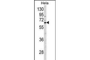 Western blot analysis of CTPS2 Antibody (N-term) (ABIN652725 and ABIN2842481) in Hela cell line lysates (35 μg/lane). (CTPS2 抗体  (N-Term))