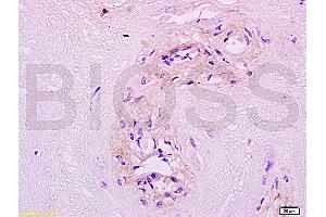 Formalin-fixed and paraffin embedded human placenta tissue labeled with Anti MFSD2A Polyclonal Antibody, unconjugated (ABIN762026) at 1:200 followed by incubation with conjugated secondary antibody and DAB staining (MFSD2A 抗体  (AA 331-430))