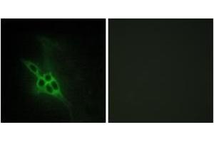 Immunofluorescence analysis of NIH-3T3 cells, using EPHB1/2/3 Antibody. (EPH Receptor B1/2/3 (AA 631-680) 抗体)