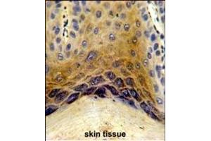 Immunohistochemistry (Paraffin-embedded Sections) (IHC (p)) image for anti-C1q and Tumor Necrosis Factor Related Protein 1 (C1QTNF1) (AA 32-61), (N-Term) antibody (ABIN390541)