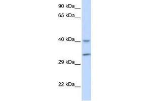 WB Suggested Anti-ALKBH3 Antibody Titration: 0. (ALKBH3 抗体  (Middle Region))