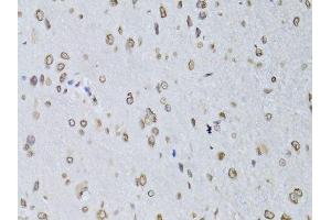 Immunohistochemistry of paraffin-embedded rat brain using LMNB2 Antibody.