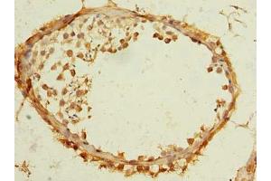 Immunohistochemistry of paraffin-embedded human testis tissue using ABIN7173115 at dilution of 1:100 (TMEM186 抗体  (AA 124-213))