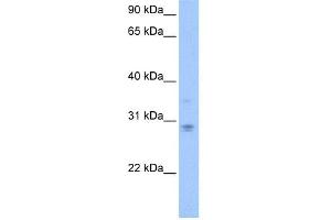 WB Suggested Anti-DCUN1D3 Antibody Titration: 0. (DCUN1D3 抗体  (C-Term))