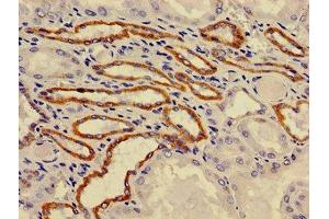 Immunohistochemistry of paraffin-embedded human kidney tissue using ABIN7175212 at dilution of 1:100 (ATP6VA1 (AA 80-260), (Isoform 1) 抗体)