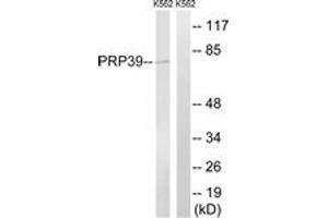 Western blot analysis of extracts from K562 cells, using PRPF39 Antibody. (PRPF39 抗体  (AA 263-312))