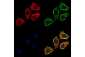 ABIN6261855 and ABIN6272633 staining HepG2 cells by IF/ICC. (GABARAPL2 抗体  (N-Term))