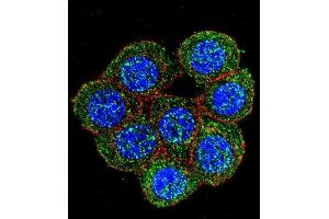 Confocal immunofluorescent analysis of PTK2 Antibody (C-term) (ABIN652554 and ABIN2842372) with 293 cell followed by Alexa Fluor 488-conjugated goat anti-rabbit lgG (green). (FAK 抗体  (C-Term))