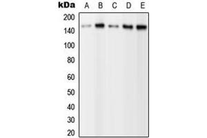 Western blot analysis of PLC gamma 2 (pY1217) expression in HEK293T EGF-treated (A), A431 (B), NIH3T3 (C), SP2/0 EGF-treated (D), H9C2 EGF-treated (E) whole cell lysates. (Phospholipase C gamma 2 抗体  (C-Term, pTyr1217))