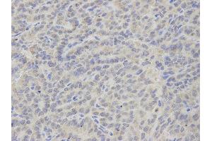 Immunohistochemistry (IHC) image for anti-thromboxane A Synthase 1 (Platelet) (TBXAS1) antibody (ABIN1875427) (TBXAS1 抗体)