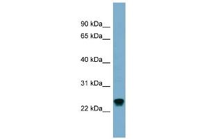 WB Suggested Anti-RAB22A Antibody Titration: 0. (RAB22A 抗体  (Middle Region))