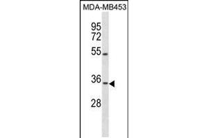 Western blot analysis in MDA-MB453 cell line lysates (35ug/lane). (OSTM1 抗体  (C-Term))