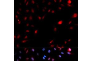 Immunofluorescence analysis of MCF-7 cells using Phospho-CDK1(Y15) Polyclonal Antibody (CDK1 抗体  (pTyr15))