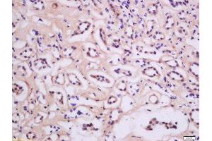 Immunohistochemistry (Paraffin-embedded Sections) (IHC (p)) image for anti-Protein Kinase C, epsilon (PRKCE) (AA 631-737) antibody (ABIN679538)