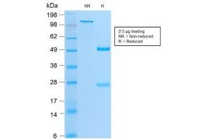 SDS-PAGE analysis of purified, BSA-free recombinant MyoD antibody (clone MYOD1/2075R) as confirmation of integrity and purity. (MYOD1 抗体)