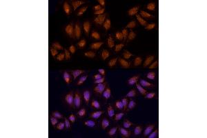 Immunofluorescence analysis of U2OS using AGPS antibody (ABIN6129641, ABIN6136644, ABIN6136645 and ABIN6214756) at dilution of 1:100 (40x lens). (AGPS 抗体  (AA 379-658))