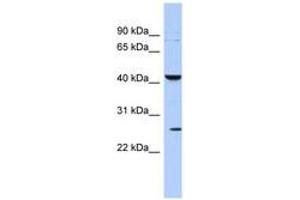 Image no. 1 for anti-Potassium Large Conductance Calcium-Activated Channel, Subfamily M, beta Member 4 (KCNMB4) (AA 71-120) antibody (ABIN6742554)