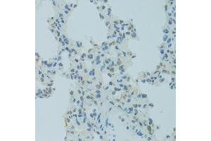 Immunohistochemistry of paraffin-embedded rat lung using MBD2 antibody (ABIN1873650) at dilution of 1:100 (40x lens). (MBD2 抗体)
