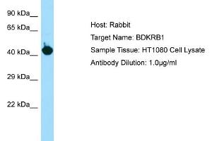 Host: RabbitTarget Name: BDKRB1Antibody Dilution: 1. (BDKRB1 抗体  (C-Term))