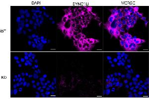 Immunocytochemical staining of HeLa cells using DYNC1LI1 antibody (ABIN7798401), 1:1,000), Top panel: wild-type (WT), Bottom panal: DYNC1LI1 shRNA knockdown (KD).