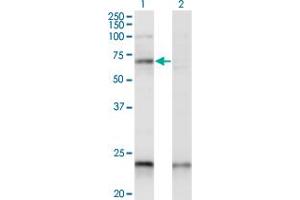 Western Blotting (WB) image for anti-CAMP Responsive Element Binding Protein 5 (CREB5) (AA 1-99) antibody (ABIN564139)