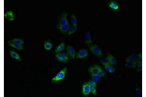 Immunofluorescent analysis of HepG2 cells using ABIN7170183 at dilution of 1:100 and Alexa Fluor 488-congugated AffiniPure Goat Anti-Rabbit IgG(H+L) (SLC25A33 抗体  (AA 66-120))